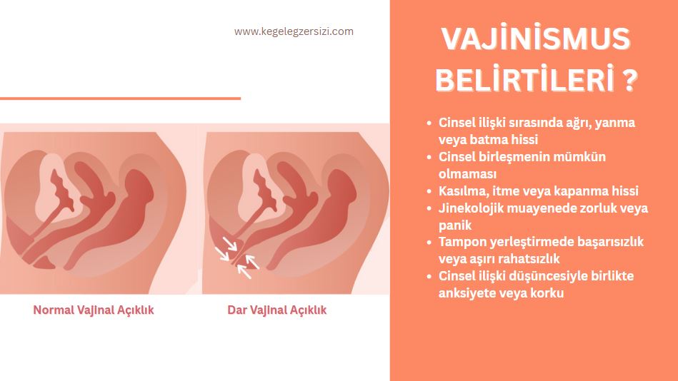 vajinismus belirtileri
